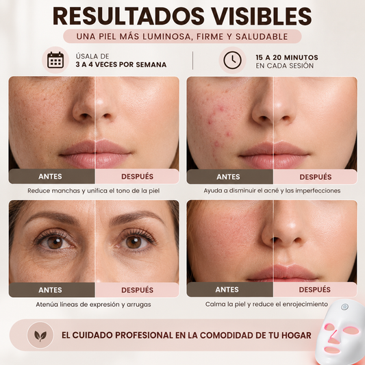 Mascarilla LED Facial — Terapia de Luz 7 Colores