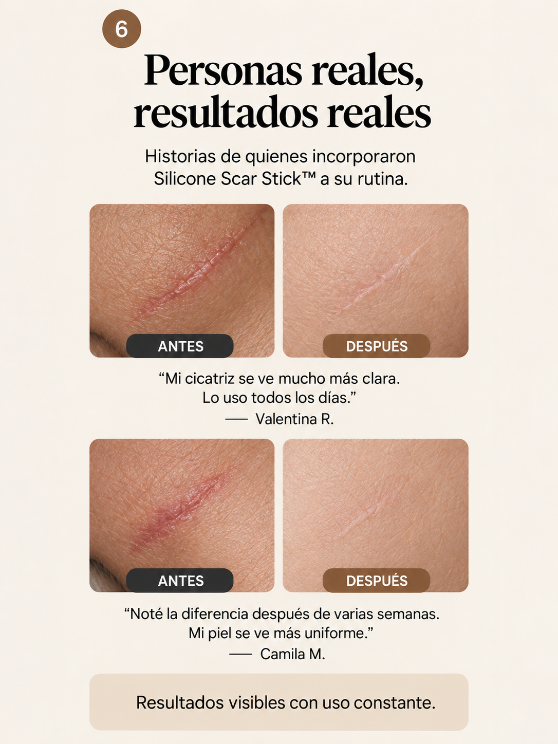 Stick Reductor de Cicatrices con Centella Asiática y Silicona