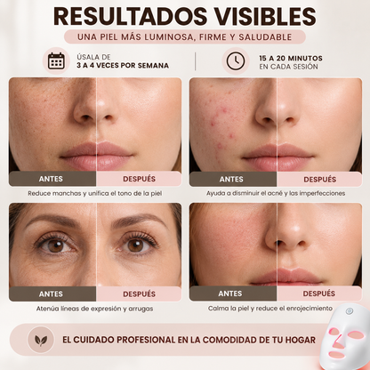 Mascarilla LED Facial — Terapia de Luz 7 Colores